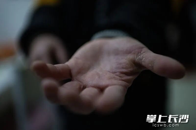 �������ϱ�늄�(d��ng)܇�ְ�ĥ���˺����O�������ϱ�늄�(d��ng)܇�ְ�ĥ���˺����O